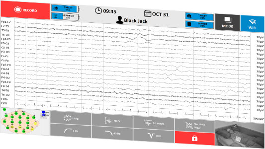 TruScan EEG Acquisition v režime JIS