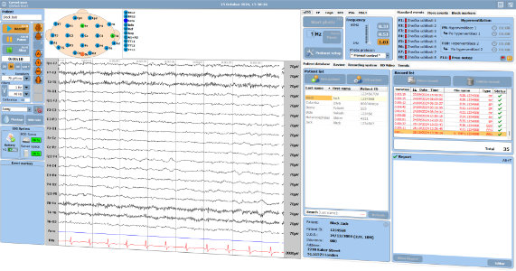 TruScan EEG Acquisition